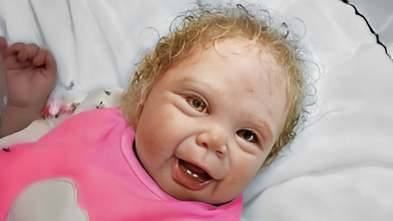 Parents Abandon Girl For Being Ugly. Years La...