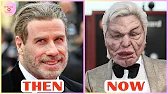 10 Celebrity Plastic Surgery Disasters You’d Never Recognize Today | Hollywood then and now
