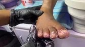 Callus Removal | Rough Foot Pedicure Technique
