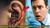 DOCTORS SHOCKED: The PIMPLE BURST — but what came out next was NOT FOR THE FAINT OF HEART!