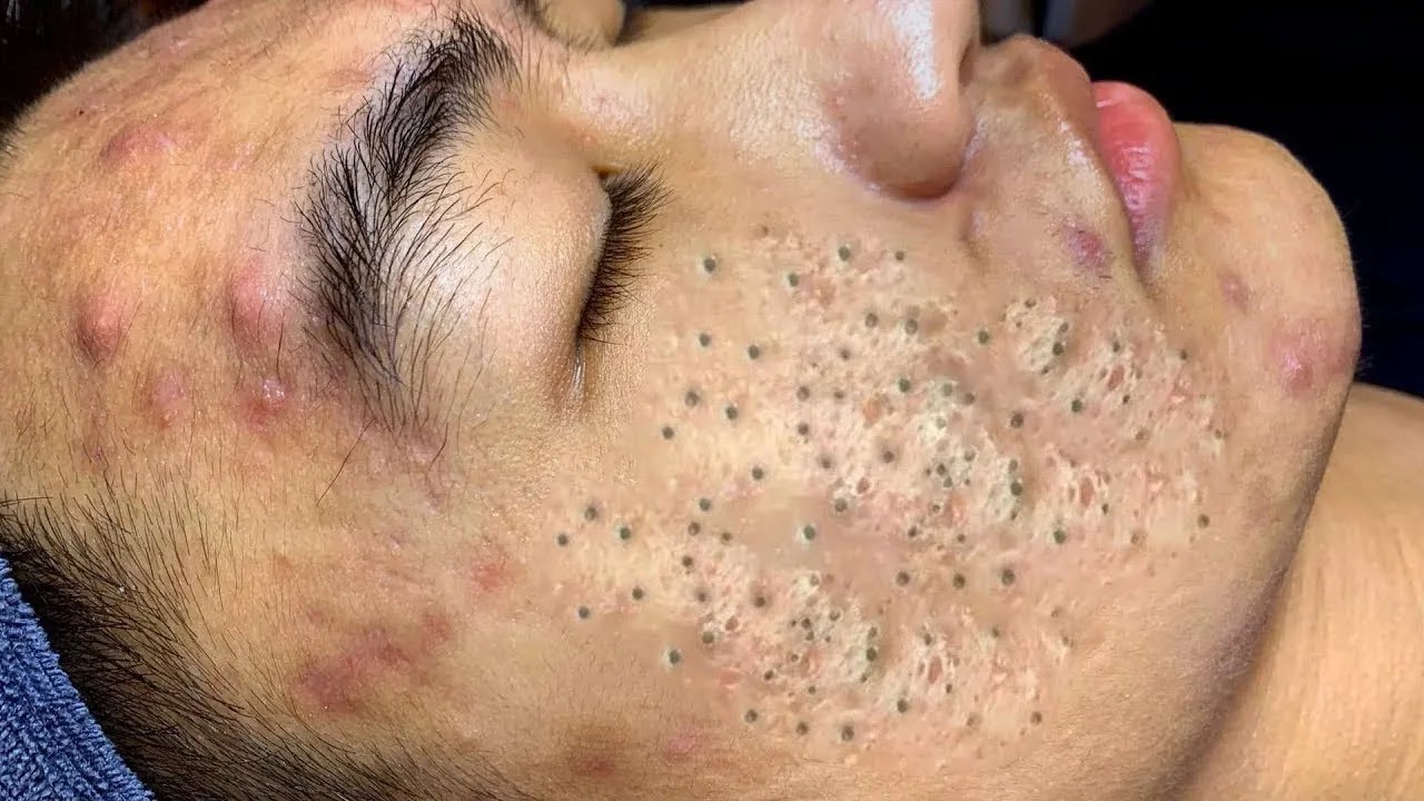 𝑺𝒐𝒐𝒕𝒉𝒊𝒏𝒈 𝑭𝒂𝒄𝒊𝒂𝒍 𝑻𝒓𝒆𝒂𝒕𝒎𝒆𝒏𝒕 𝒇𝒐𝒓 𝑺𝒕𝒓𝒆𝒔𝒔 𝑹𝒆𝒍𝒊𝒆𝒇 | 𝑫𝒆𝒆𝒑 𝑪𝒍𝒆𝒂𝒏𝒊𝒏𝒈 & 𝑪𝒂𝒍𝒎𝒊𝒏𝒈 𝑴𝒂𝒔𝒔𝒂𝒈𝒆 𝒂𝒕 𝑳𝒖𝒙𝒖𝒓𝒚 𝑺𝒑𝒂 #𝟓𝟕𝟓𝟎