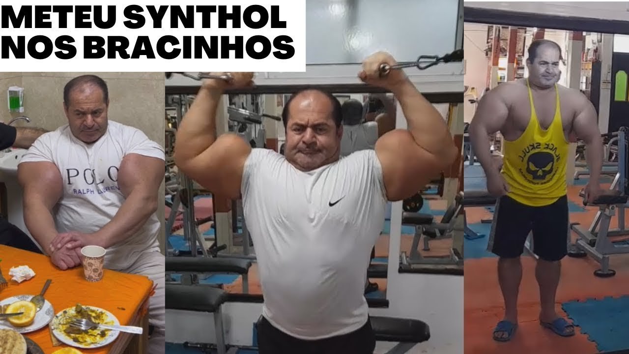 Troll Maromba - O Iraniano que meteu SYNTHOL nos braços