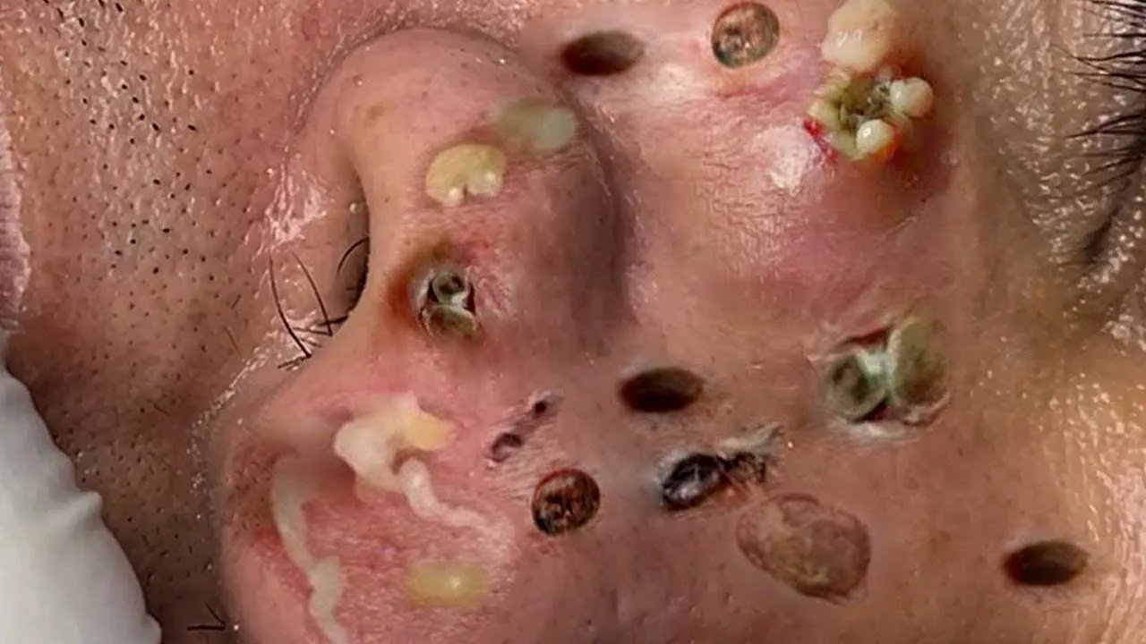 𝑅𝑒𝑐𝑙𝑎𝑖𝑚 𝑌𝑜𝑢𝑟 𝐺𝑙𝑜𝑤 𝐴𝑛𝑑 𝐶𝑎𝑙𝑚 𝑇ℎ𝑟𝑜𝑢𝑔ℎ 𝑀𝑖𝑛𝑑𝑓𝑢𝑙 𝑆𝑘𝑖𝑛𝑐𝑎𝑟𝑒 𝑀𝑜𝑚𝑒𝑛𝑡𝑠| 𝐷𝑒𝑒𝑝 𝐶𝑙𝑒𝑎𝑛𝑠𝑖𝑛𝑔 & 𝑆𝑜𝑜𝑡ℎ𝑖𝑛𝑔 𝑀𝑎𝑠𝑠𝑎𝑔𝑒 #9055