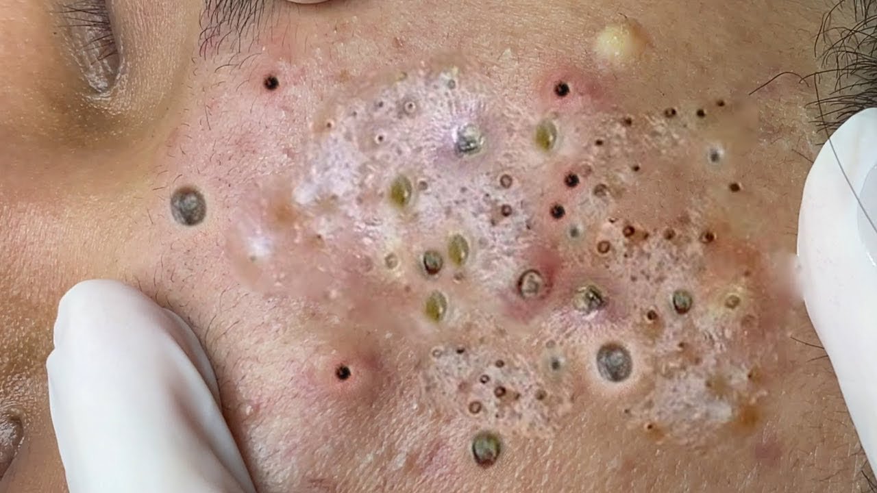 𝑅𝑒𝑐𝑙𝑎𝑖𝑚 𝑌𝑜𝑢𝑟 𝐺𝑙𝑜𝑤 𝐴𝑛𝑑 𝐶𝑎𝑙𝑚 𝑇ℎ𝑟𝑜𝑢𝑔ℎ 𝑀𝑖𝑛𝑑𝑓𝑢𝑙 𝑆𝑘𝑖𝑛𝑐𝑎𝑟𝑒 𝑀𝑜𝑚𝑒𝑛𝑡𝑠| 𝐷𝑒𝑒𝑝 𝐶𝑙𝑒𝑎𝑛𝑠𝑖𝑛𝑔 & 𝑆𝑜𝑜𝑡ℎ𝑖𝑛𝑔 𝑀𝑎𝑠𝑠𝑎𝑔𝑒 #𝟗𝟎𝟏𝟑