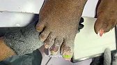 Pedicure Product removal